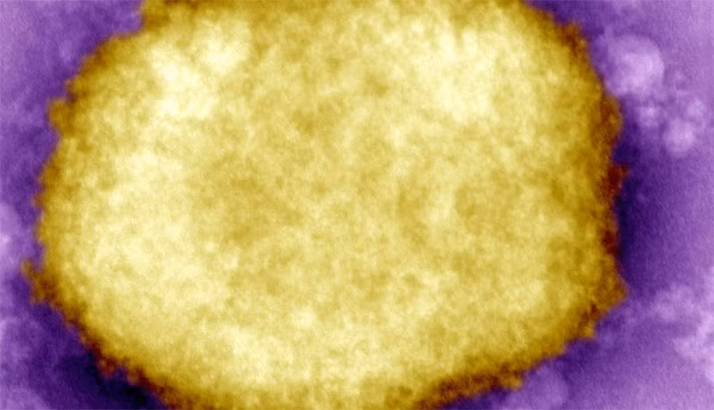 Một loại virus đậu mùa khỉ. (Ảnh: Thời báo Hà Lan)