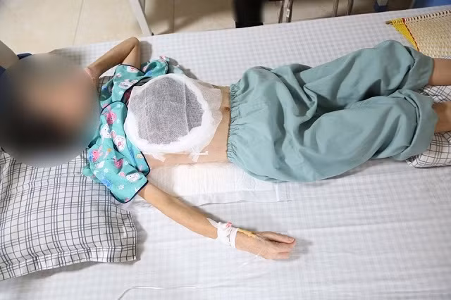 Cẩn thận khi dùng thuốc nam chữa ung thư