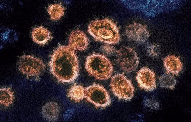 Virus gây ra Covid-19, được gọi là SARS-CoV-2 dưới kính hiển vi điện tử.