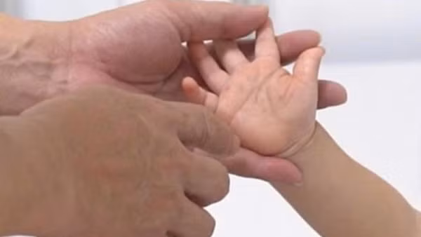 Bệnh nhi mắc tay chân miệng điều trị tại Bệnh viện Nhi Trung ương. (Ảnh: BVCC)