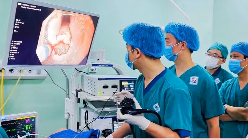 Ông C được can thiệp bằng nội soi ESD tại Bệnh viện Trung ương Thái Nguyên để điều trị ung thư thực quản.