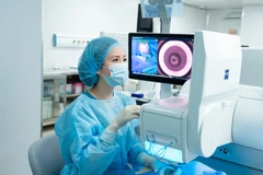 Công nghệ phẫu thuật tật khúc xạ SMILE Pro Vision ID giúp dự báo xu hướng thay đổi thị lực.