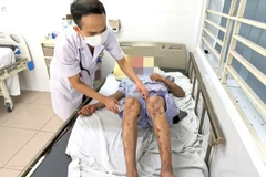 Bệnh nhân rơi vào tình trạng mù tạm thời. 