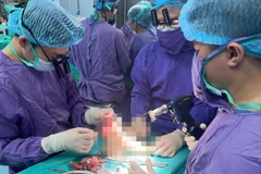 Kíp y, bác sĩ thực hiện ca phẫu thuật xuyên đêm cứu bàn chân cho nữ sinh gặp nạn.