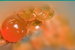 Dị vật được lấy ra là những hạt nhựa nhỏ, có khả năng trương nở khi gặp nước.