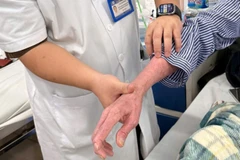 Các tổn thương của người bệnh.