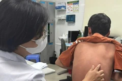 Thạc sĩ, bác sĩ Nguyễn Thị Mai Hương - Khoa Điều trị nội trú ban ngày, Bệnh viện Da liễu Trung ương khám cho bệnh nhân. 