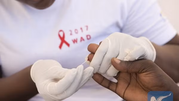 Một người được xét nghiệm HIV miễn phí trong các hoạt động nhân Ngày Thế giới phòng chống AIDS tại Kigali, Rwanda. (Ảnh: Tân Hoa Xã)