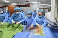 Các bác sĩ khoa Tim mạch-Lồng ngực, Bệnh viện Thống Nhất quyết định áp dụng phương pháp thay van động mạch chủ qua da.