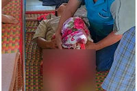 Ngay khi vào đất liền, ngư dân Huỳnh Văn Chí được đưa ngay đến Trạm Y tế Sông Đốc để được chăm sóc, chữa trị.