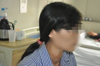 Bệnh nhân đang được điều trị tại Bệnh viện Nội tiết Trung ương.