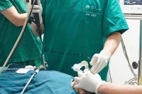 Nội soi gắp dị vật đường thở cho bệnh nhi.