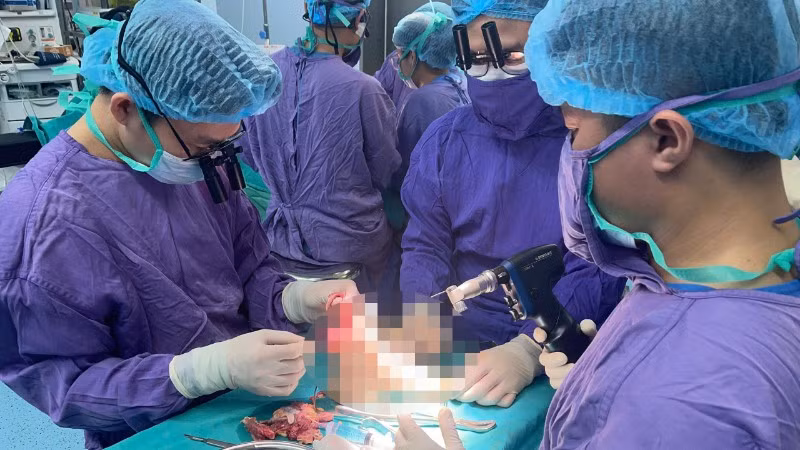 Kíp y, bác sĩ thực hiện ca phẫu thuật xuyên đêm cứu bàn chân cho nữ sinh gặp nạn.