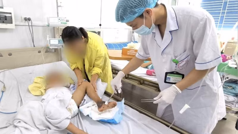 Bác sĩ làm sạch vết thương cho bệnh nhi. 