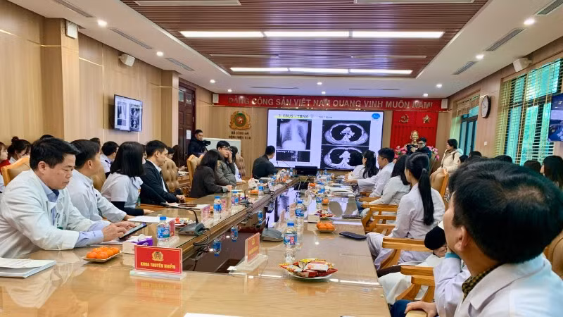 Tiến sĩ, bác sĩ Masao Hashimoto đang chia sẻ kỹ thuật nội soi siêu âm phế quản cho các bác sĩ Bệnh viện 19-8.