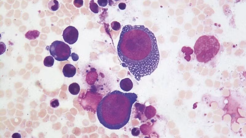 Parvovirus B19 tập trung lây nhiễm ở các tế bào phân chia nhanh, gây độc làm cho tế bào chết nhanh và gây viêm xung quanh. (Ảnh minh họa)