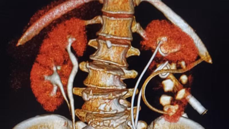 Hình ảnh trên phim chụp của người bệnh.