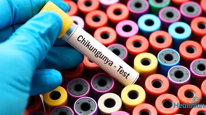 Đợt bùng phát virus Chikungunya đã bắt đầu từ đầu năm nay.