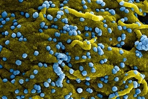 WHO: Ethiopia tuyên bố khống chế được đợt bùng phát virus Marburg