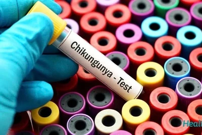 Đợt bùng phát virus Chikungunya đã bắt đầu từ đầu năm nay.