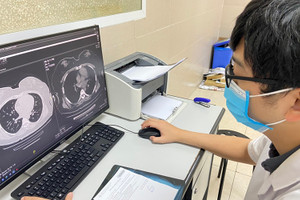 Hậu Covid-19 vẫn ho, có nên dùng kháng sinh?