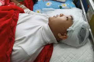 Học sinh Phan Thanh Lâm bị thương vùng đầu đang được chăm sóc, điều trị tại Bệnh viện Đa khoa tỉnh Thanh Hóa.