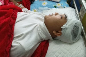 Học sinh Phan Thanh Lâm bị thương vùng đầu đang được chăm sóc, điều trị tại Bệnh viện Đa khoa tỉnh Thanh Hóa.