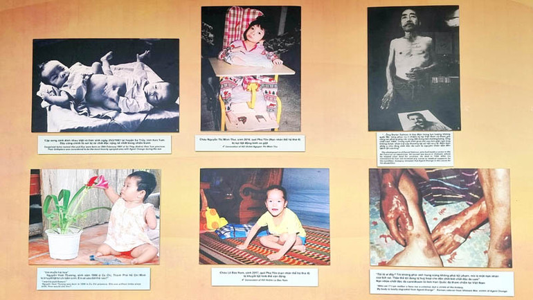 Hình ảnh về nỗi đau da cam ở Việt Nam trưng bày tại triển lãm.