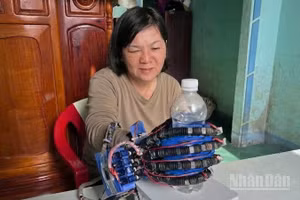 Găng tay thông minh tích hợp trí tuệ nhân tạo, hỗ trợ tập vật lý trị liệu và trợ lực cho người suy nhược cơ ngón tay.