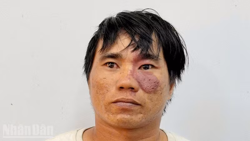 Bị can Lê Công Bằng.
