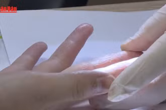 [Video] Cảnh báo gia tăng các bệnh về da trong mùa mưa
