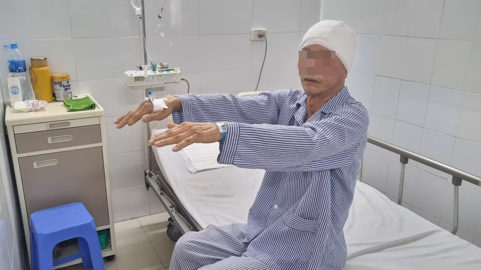 Bệnh nhân tỉnh táo, vận động tốt sau mổ 1 ngày.