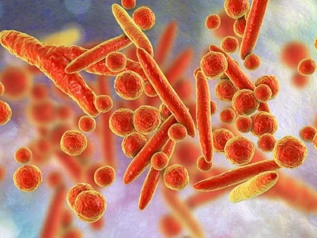 Viêm phổi do Mycoplasma là một bệnh nhiễm trùng ở phổi khá phổ biến. Viêm phổi do Mycoplasma là một bệnh nhiễm trùng ở phổi khá phổ biến.