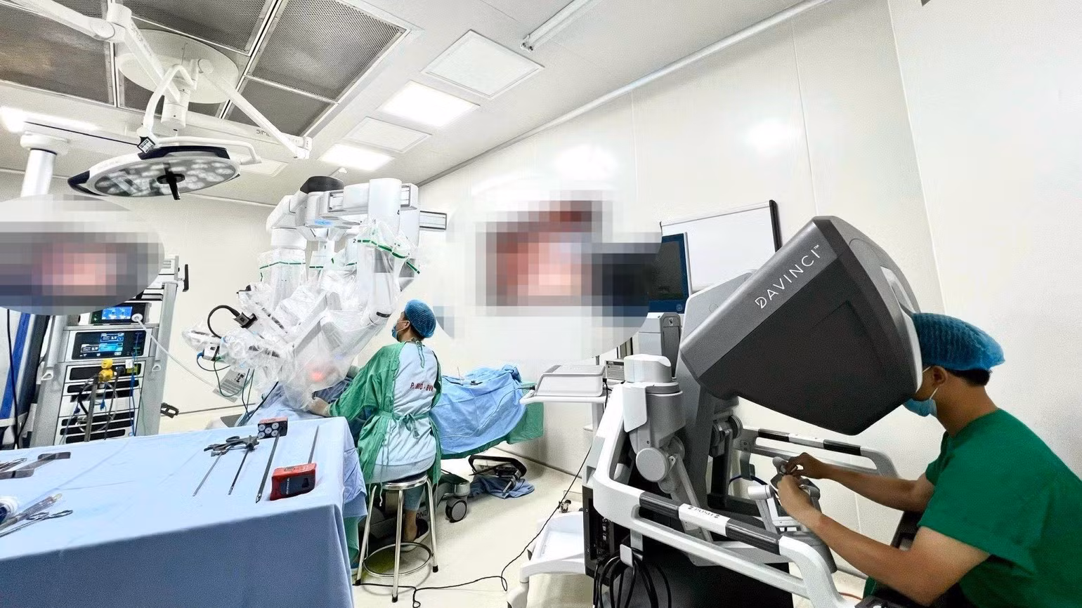 Phẫu thuật robot cắt tuyến giáp qua tiền đình.