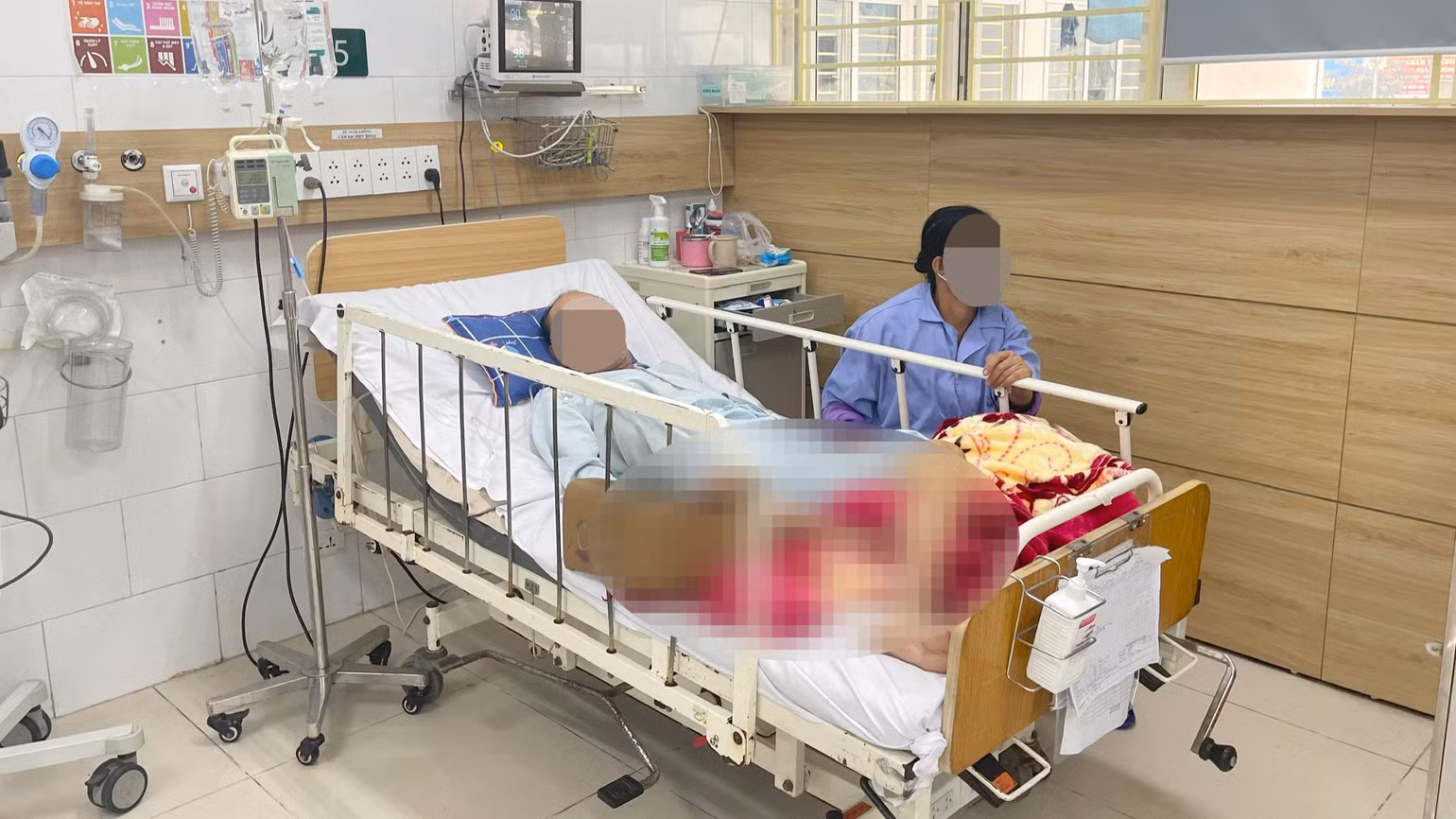 Bệnh nhân đang điều trị tại Bệnh viện Bạch Mai.