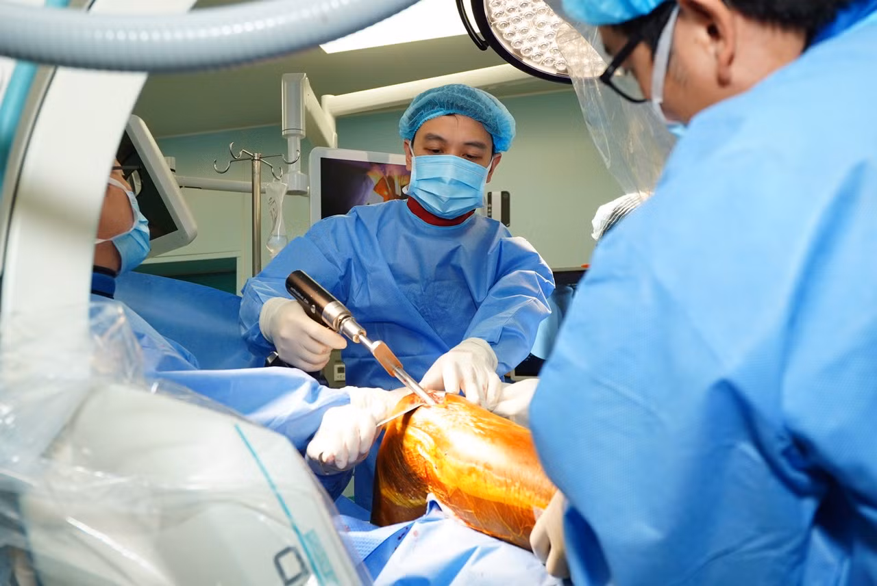 Các bác sĩ thực hiện kỹ thuật đóng đinh nội tủy kín để bảo đảm giữ được giải phẫu.
