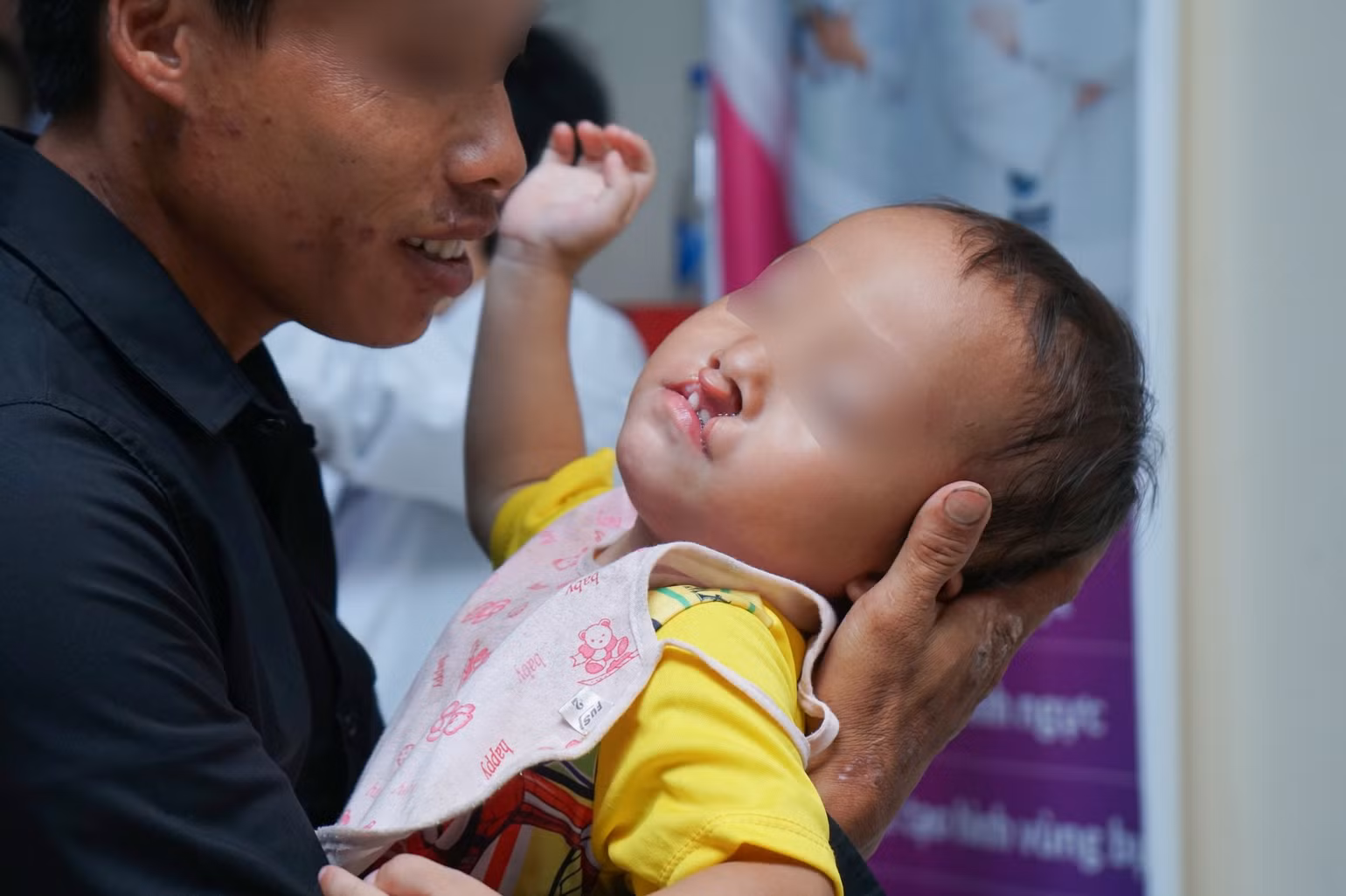 Bệnh nhi dị tật bẩm sinh được thăm khám, sắp xếp lịch phẫu thuật.