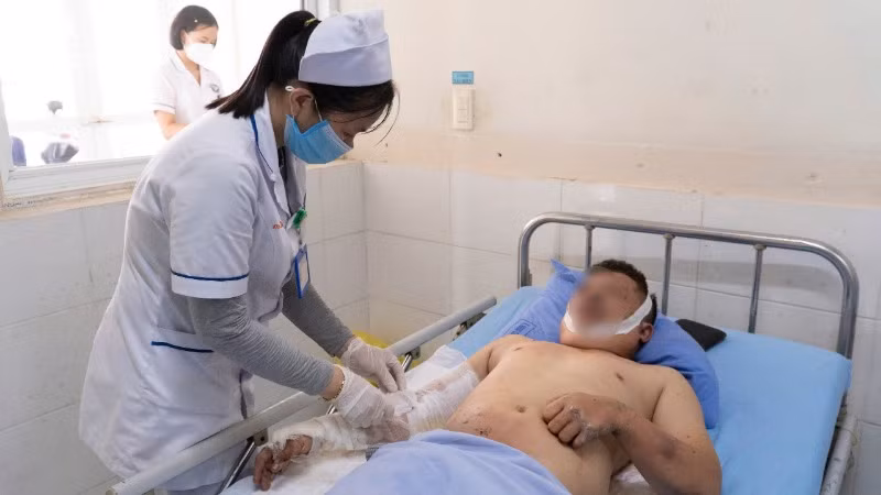 Công nhân bị bỏng trong vụ nổ đang được chăm sóc, điều trị, xử lý vết thương tại khoa Ngoại chấn thương, Bệnh viện Đa khoa Trung ương Quảng Nam. Công nhân bị bỏng trong vụ nổ đang được chăm sóc, điều trị, xử lý vết thương tại khoa Ngoại chấn thương, Bệnh viện Đa khoa Trung ương Quảng Nam.