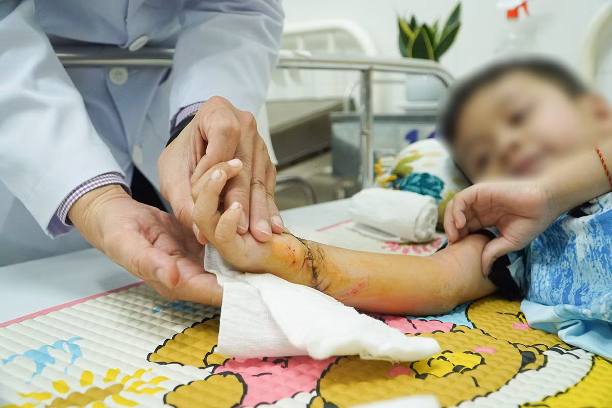Hiện tại dịch ở vết mổ cẳng bàn tay phải đã khô, bàn tay cũng hồng ấm và các ngón tay đã vận động nhẹ được.