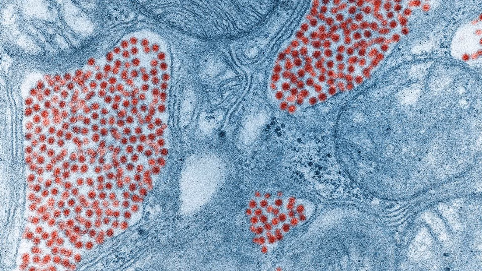 Hình ảnh virus qua kính hiển vi điện tử. (Ảnh: Public Domain/Wikipedia) Hình ảnh virus qua kính hiển vi điện tử. (Ảnh: Public Domain/Wikipedia)