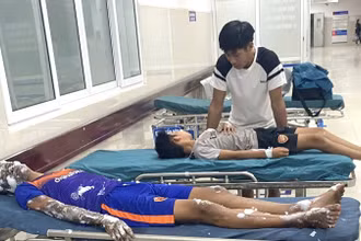 4 học sinh ở Quảng Bình phải nhập viện cấp cứu do làm pháo theo hướng dẫn trên Youtube.