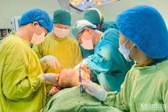 Phẫu thuật bóc tách thành công khối u gần 5kg vùng hàm mặt cho bệnh nhân nữ tại Trung tâm ung bướu, Bệnh viện Đa khoa tỉnh Thái Bình.