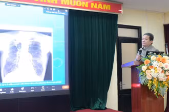 Tiến sĩ, bác sĩ cao cấp Đinh Văn Lượng, Giám đốc Bệnh viện Phổi Trung ương chia sẻ về bệnh nấm phổi.