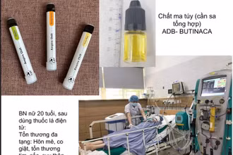 Một bệnh nhân cấp cứu tại Trung tâm chống độc sau khi dùng thuốc lá điện tử có chất ma túy.