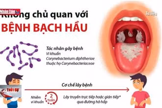 Bắc Giang khống chế không để dịch bạch hầu lây lan