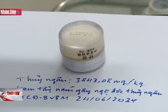 Ngộ độc thủy ngân từ mỹ phẩm mua trên mạng