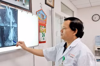 Bác sĩ hội chẩn về hiện trạng khối phổi biệt lập của bệnh nhân trên hình ảnh phim chụp CT Scan. (Ảnh: ANH ĐÀO)