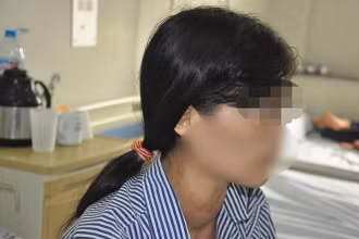 Bệnh nhân đang được điều trị tại Bệnh viện Nội tiết Trung ương.