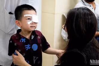 Bệnh nhi được bóc giả mạc tại Bệnh viện Nhi Trung ương. (Ảnh: THẾ KHẢI)