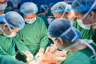 Các bác sĩ tiến hành ghép phổi cho bệnh nhân Cấn Thị Phương. 